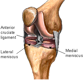 torn cartilage - american football injuries
